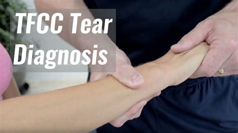 test to diagnose tfcc tear|positive test for tfcc.